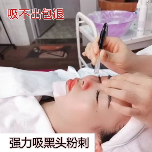 脸部去黑头 收缩毛孔粉刺 深层清洁吸油机