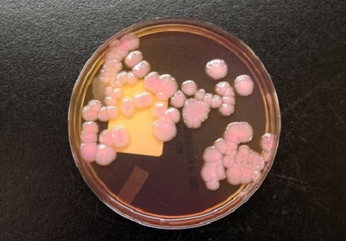 抗碳青霉烯类肠杆菌