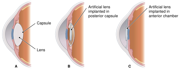 Fig.2.png