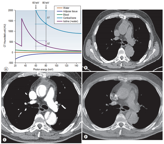 Dual-energy imaging exploits this to identify individual chemical components within a structure
