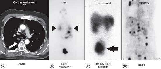 Examples of everyday molecular imaging